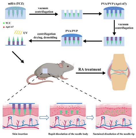 Pharmaceutics Free Full Text Dual Drug Loaded Separable