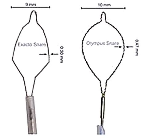 Cold snare polypectomy for removal of colonic lesions | World Endoscopy ...