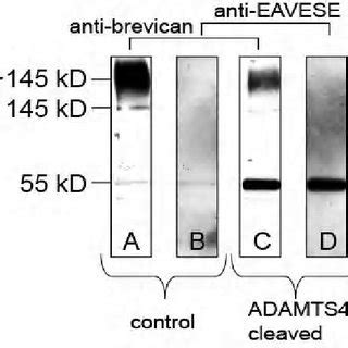 Binding Of Wisteria Floribunda Agglutinin WFA Lectin To Fixed Tissue