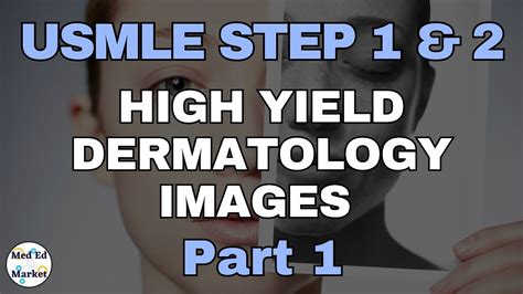 High Yield Dermatology Images Usmle Step Step Comlex Part