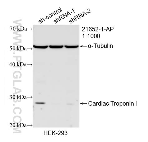 Cardiac Troponin I Antibody 21652 1 AP Proteintech