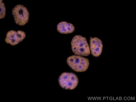 Fustls Polyclonal Antibody Coralite® 555 Cl55511570100ul