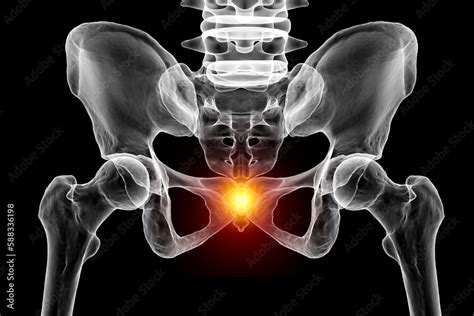 A 3D medical illustration highlighting the coccyx bone marked in red ...