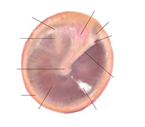 Tympanic Membrane Diagram Quizlet