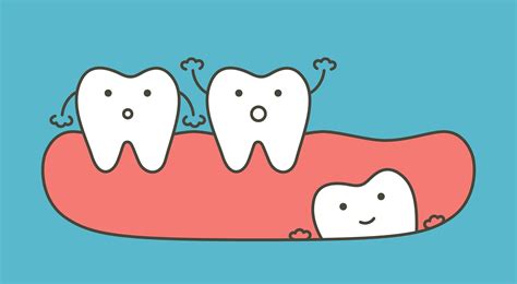 Wisdom Teeth Removal: Know Before You Go - Ask the Dentist