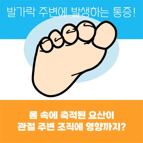 퓨린 많은 음식으로 류마티스내과 돌봄을 받으세요 [서면 류마이준희내과의원] 네이버 블로그