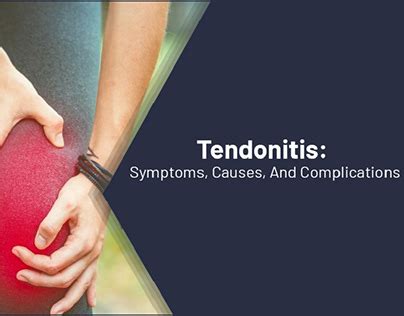 Tendonitis Projects :: Photos, videos, logos, illustrations and branding :: Behance