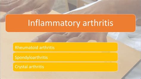 Inflammatory Arthritis Ppt