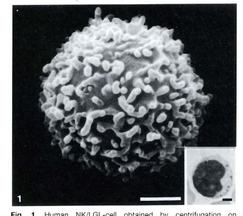 Figure From Scanning Electron Microscopic Study Of Natural Killer