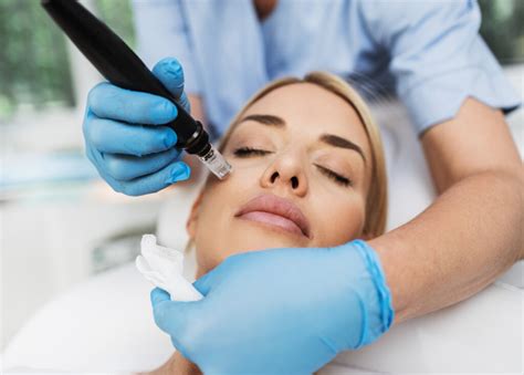 Microneedling Risks And Rewards What You Need To Know For Healthy