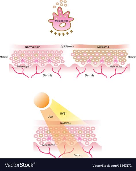 Melanocyte melanin melanogenesis Royalty Free Vector Image