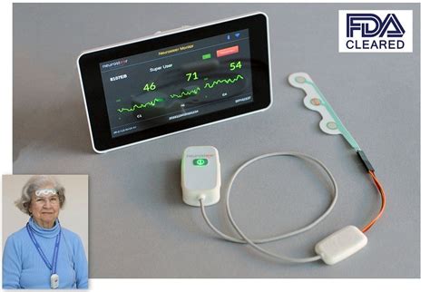 Neurosteer Receives Fda Approval For Brain Monitoring System