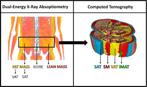 Quantification Of Adipose Tissues By Dual Energy X Ray Absorptiometry