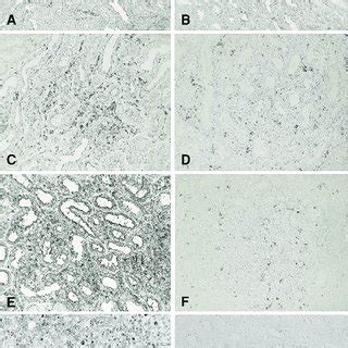 Expression Of Protease Inhibitor PI 9 By Renal Tubular Cells And