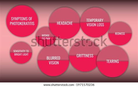 Symptoms Photokeratitis Vector Illustration Medical Journal Stock Vector Royalty Free