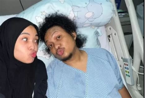 Sempat Diderita Babe Cabita Apa Itu Penyakit Anemia Aplastik Krjogja