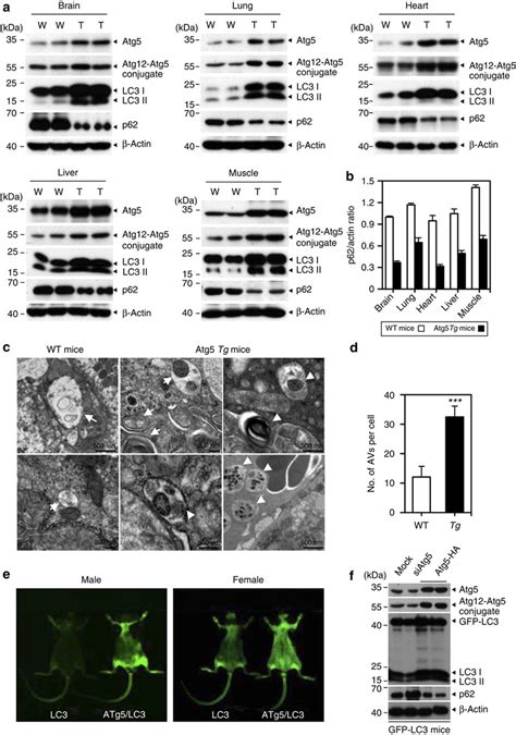 Enhanced Autophagy In Atg Tg Mice A Western Blot Analysis Showing