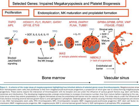 Inherited Thrombocytopenias History Advances And Perspectives