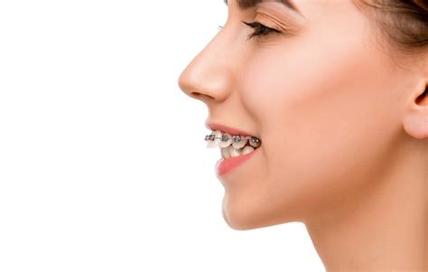 What Are The Differences Between An Overjet And An Overbite