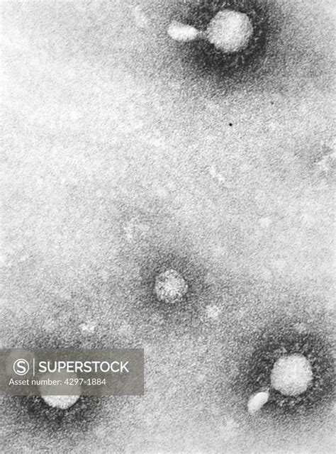 Negatively Stained Transmission Electron Micrograph Of Venezuelan