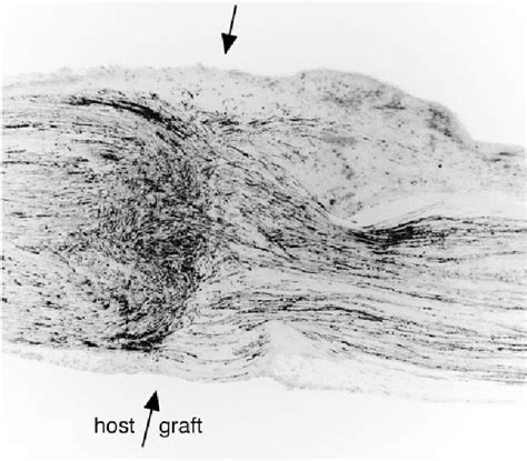 Figure 1 From Axonal Regeneration Into Acellular Nerve Grafts Is