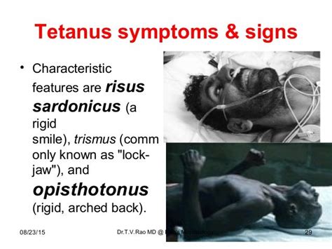 Tetanus Teaching basics