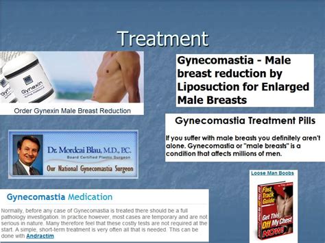 Ppt Gynecomastia Powerpoint Presentation Free Download Id 3336596