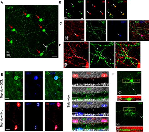 Local Retinal Circuits Of Melanopsin Containing Ganglion Cells