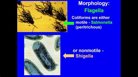 15 40 Enterobacteriaceae Coliforms YouTube