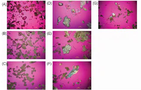 Photomicrographs Obtained From Polarized Light Microscope A ERS