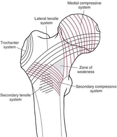 Biomechanics Of Femoral Neck Fractures In Runners Lower Extremity