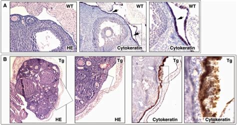 A The Ovarian Surface Epithelium In Wild Type Mouse B The Ovarian