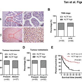 Low Expression Of Hltf Is Positively Associated With Clinical