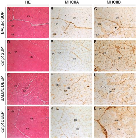 Immunohistochemical Analysis Of Myosin Heavy Chain Mhc Isoforms In