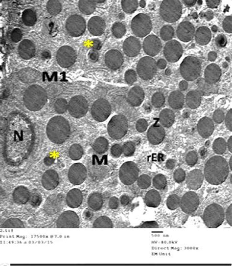 An Electron Micrograph Of An Ultrathin Section From The Exocrine Part