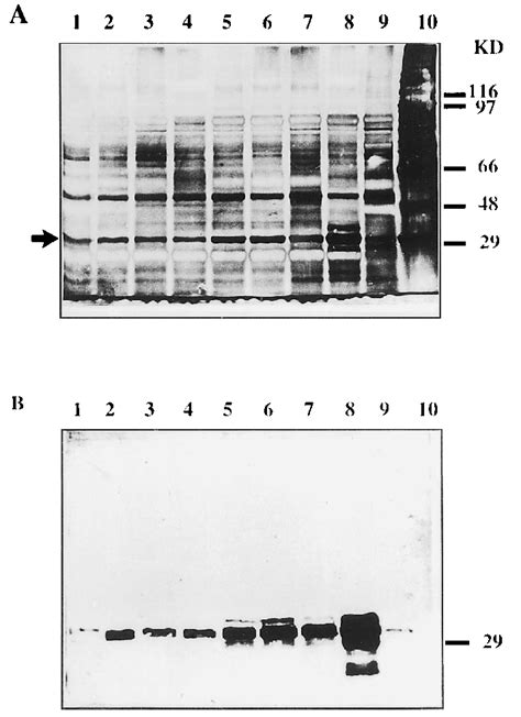 A B Polyacrylamide Gel Electrophoresis Of Extra Cellular Proteins Download Scientific Diagram