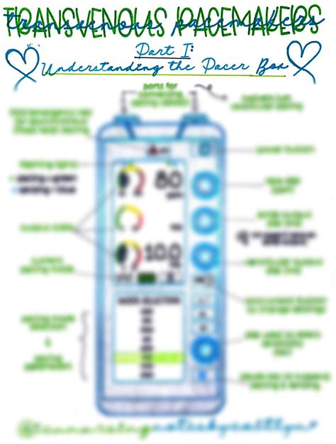 Anatomy Of A Transvenous Pacemaker Box Etsy