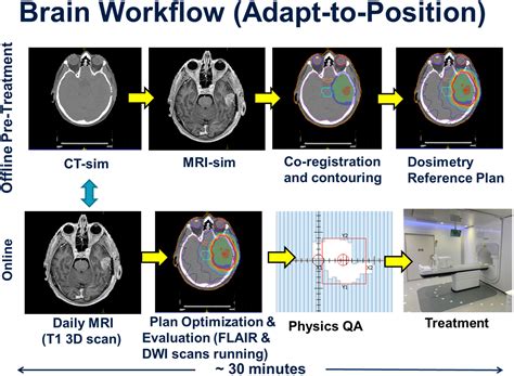 Frontiers High Grade Glioma Radiation Therapy On A High Field