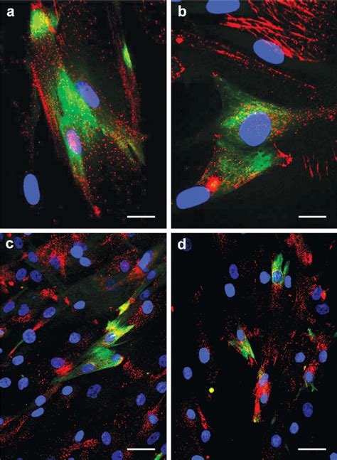 Expression Of Cd133 And Nestin In Rhabdomyosarcoma Cell Lines