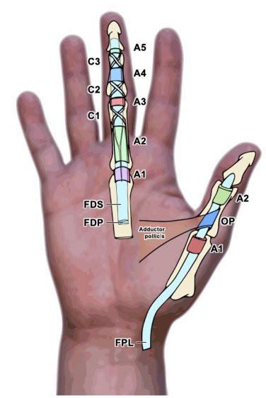 Flexor Tendon Injuries Repair Rehabilitation Injury