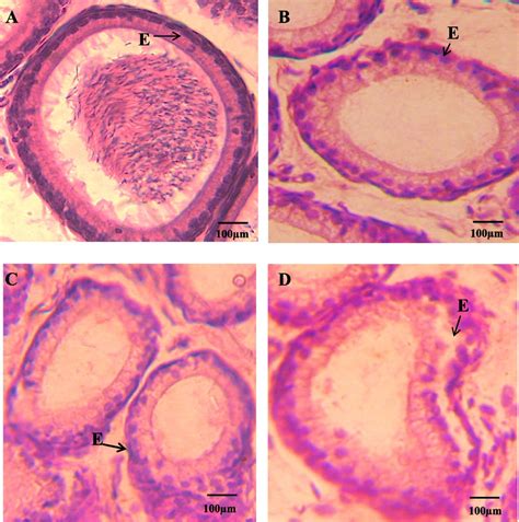 Photomicrograph Hande 40x Of The Cross Section Of Cauda Of Epididymis