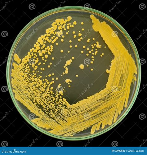 Yellow Bacterial Colonies Culture On Petri Dish Isolated On Black Stock