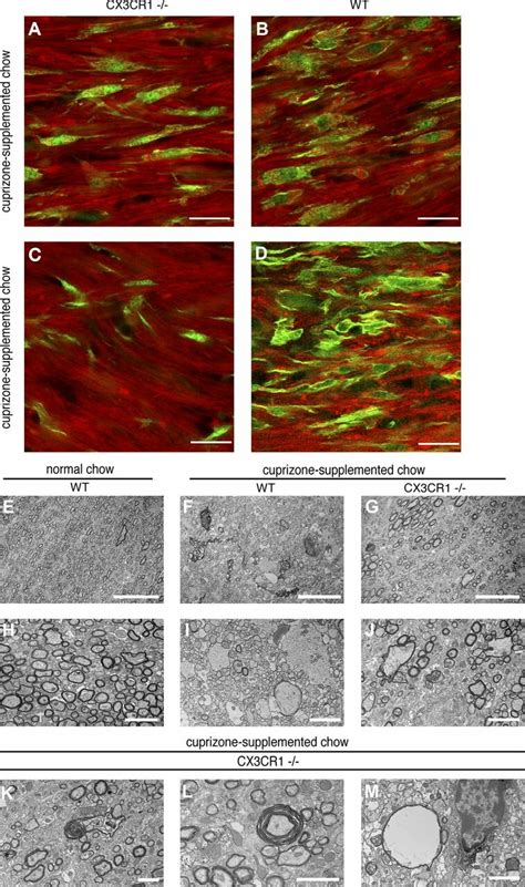 Myelin staining and electron microscopy reveal the presence of ...