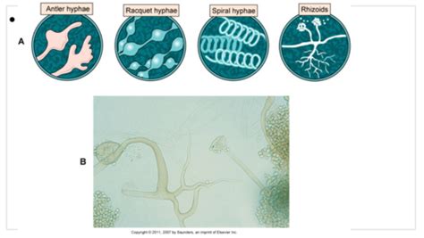 MLT 209 Fungi Lab Practical Flashcards | Quizlet 