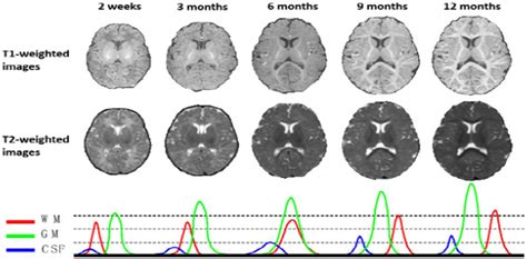 Frontiers Deep Learning Techniques For Isointense Infant Brain Tissue