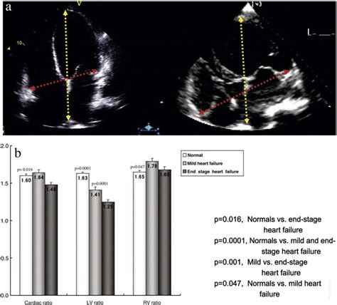 Echocardiograms A From Patients With Heart Failure Mild Left And