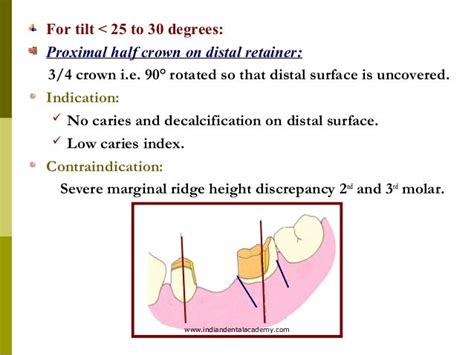 Abutment Evaluation Cosmetic Dentistry Training