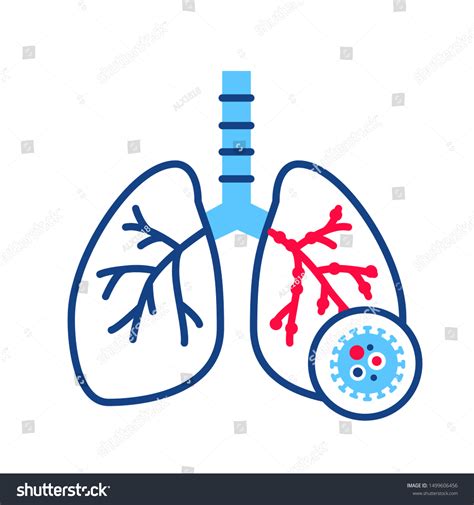 Bronchitis Line Color Icon Inflammatory Process Stock Vector Royalty