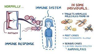 Distributive Shock What Is It Signs Treatment And More Osmosis