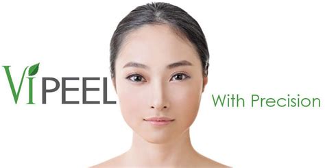 Vi Peel Review | True to its claims? - Collagen Mentor